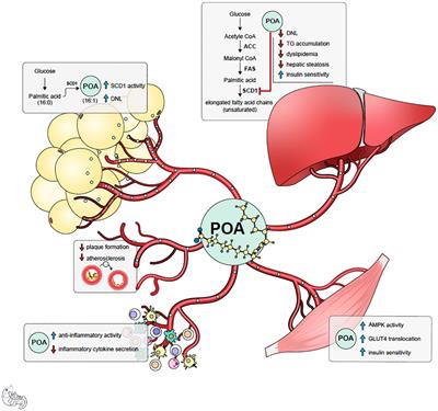 Protocol for a randomized placebo-controlled clinical trial using pure palmitoleic acid to ameliorate insulin resistance and lipogenesis in overweight and obese subjects with prediabetes